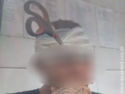 Jovem fica com tesoura cravada na cabeça após “brincadeira” em MS