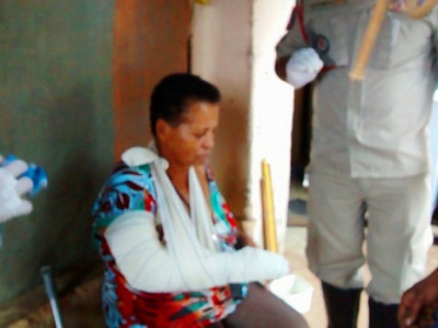 Idosa tem braço quebrado por ex marido ao ser agredida Idosa tem braço quebrado por ex marido ao ser agredida