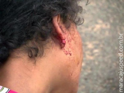Grávida tem orelha cortada durante briga com marido