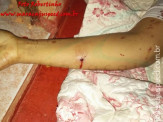 Maracaju: Mulher é assassinada com mais de 20 tiros e filho assiste a violência (atualizada)