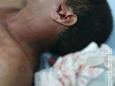 Final de semana acelerado em Maracaju; homem leva facada no rosto