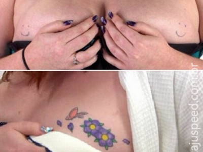Mulher se arrepende de tatuagens de carinhas sorridentes nos seios