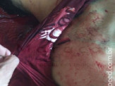 Maracaju: Adolescente mata homem com cerca de 10 golpes de faca, e só para de esfaquear porque faca entorta