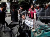 Explosão em bairro de embaixadas em Cabul mata 80 e deixa mais de 300 feridos