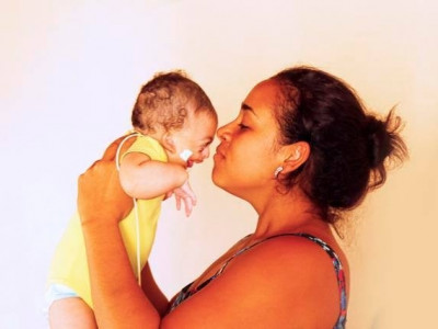 Com síndrome rara, bebê de Campo Grande precisa de R$ 10 mil para cirurgia