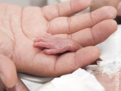 Hospital melhora ganho de peso de micro-prematuros priorizando leite materno