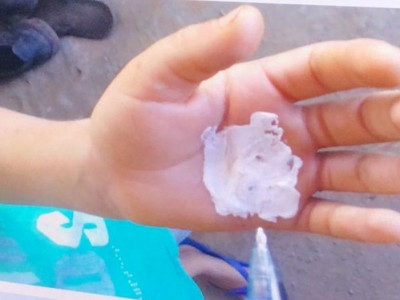 Mãe queima mão de menino de 6 anos em fogão por ter pego dinheiro de sua bolsa para comprar chiclete em MS