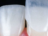 Maracaju: Consultório Odontológico Maria de Lourdes tira dúvidas sobre tratamentos estéticos dentais
