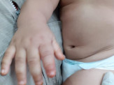 Maracaju: Bebê de apenas 8 meses de vida é picado por escorpião na Vila Adrien. Corpo de Bombeiros realizou socorro do bebê