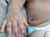 Maracaju: Bebê de apenas 8 meses de vida é picado por escorpião na Vila Adrien. Corpo de Bombeiros realizou socorro do bebê Maracaju: Bebê de apenas 8 meses de vida é picado por escorpião na Vila Adrien. Corpo de Bombeiros realizou socorro do bebê