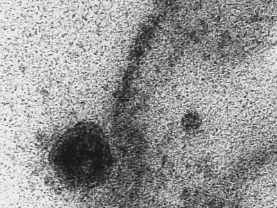 Aplicativo alimentado por tosses pode ajudar na detecção da covid-19 Aplicativo alimentado por tosses pode ajudar na detecção da covid-19