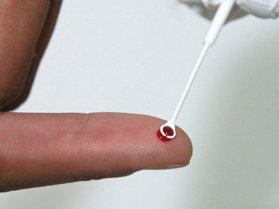 HIV: estudo mostra resistência de mutação a remédio usado no Brasil HIV: estudo mostra resistência de mutação a remédio usado no Brasil