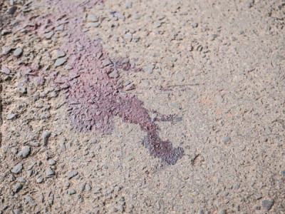 Dupla em motocicleta faz disparos e atinge adolescente de 17 anos Dupla em motocicleta faz disparos e atinge adolescente de 17 anos