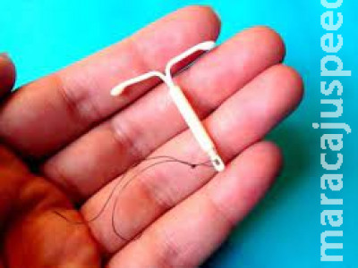 PL que proíbe consentimento de cônjuge para implantação de  PL que proíbe consentimento de cônjuge para implantação de