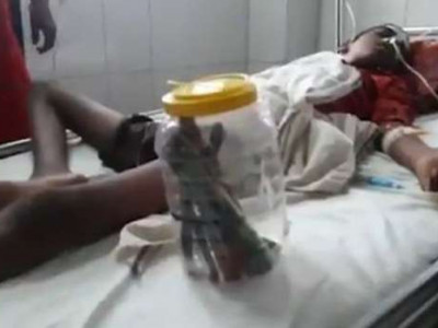 Adolescente engole 16 escovas de dente e prego a pedido de médico Adolescente engole 16 escovas de dente e prego a pedido de médico