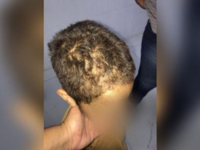Pai e madrasta são presos por torturar criança de 7 anos em Goiás