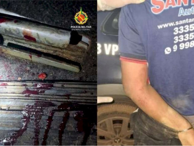 Mulher é encontrada sem roupa, estuprada e com parte do braço arrancado Mulher é encontrada sem roupa, estuprada e com parte do braço arrancado