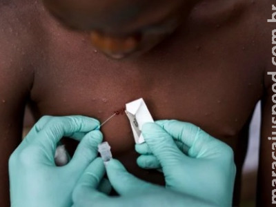 Anvisa alerta para volta de uso de máscara contra varíola dos macacos Anvisa alerta para volta de uso de máscara contra varíola dos macacos