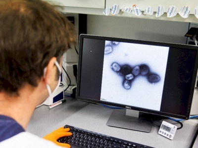 Primeiro caso de varíola do macaco na América do Sul é confirmado na Argentina