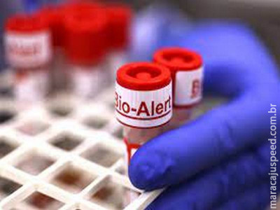 Ministério da Saúde lança Plano de Contingência Nacional para varíola dos macacos Ministério da Saúde lança Plano de Contingência Nacional para varíola dos macacos