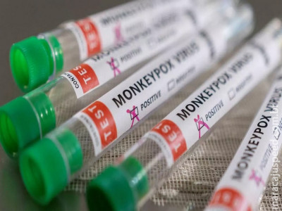 MS investiga primeira suspeita de morte de paciente com varíola dos macacos MS investiga primeira suspeita de morte de paciente com varíola dos macacos