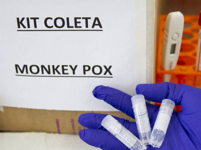 OMS reafirma que situação da varíola do macaco no Brasil é  OMS reafirma que situação da varíola do macaco no Brasil é
