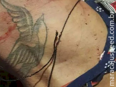 Morta em acidente de trânsito não usava capacete e quebrou o pescoço Morta em acidente de trânsito não usava capacete e quebrou o pescoço