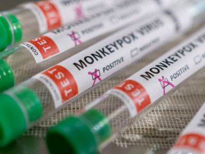 São Paulo inicia vacinação de pessoas com baixa imunidade contra mpox São Paulo inicia vacinação de pessoas com baixa imunidade contra mpox