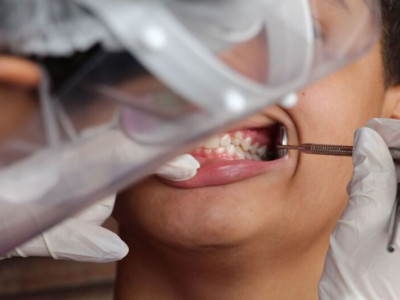 Lula sanciona PL que inclui política nacional de saúde bucal no SUS Lula sanciona PL que inclui política nacional de saúde bucal no SUS