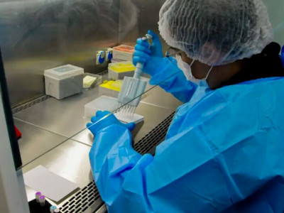 Startup desenvolve teste para rastreamento de câncer do colo do útero Startup desenvolve teste para rastreamento de câncer do colo do útero