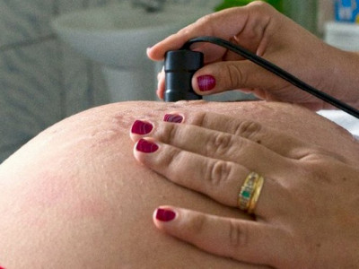 Teste para HTLV passa a ser indicado para gestantes durante pré-natal Teste para HTLV passa a ser indicado para gestantes durante pré-natal