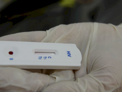 Saúde orienta farmácias sobre testes para HIV, sífilis e hepatites Saúde orienta farmácias sobre testes para HIV, sífilis e hepatites