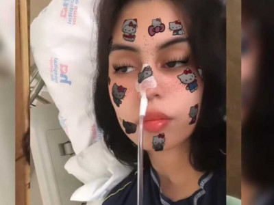 Jovem com doença hereditária retira o intestino e detalha experiência  Jovem com doença hereditária retira o intestino e detalha experiência