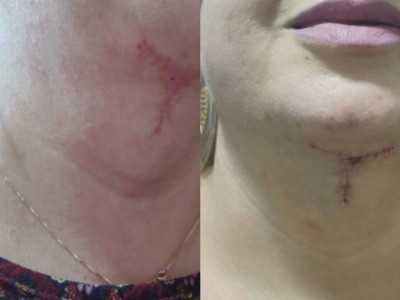 Dentista acusada de erros graves se defende e nega irregularidades:  Dentista acusada de erros graves se defende e nega irregularidades: