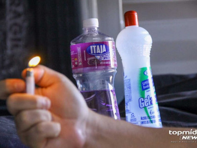 Criança tem rosto queimado em acidente com álcool em Anaurilândia Criança tem rosto queimado em acidente com álcool em Anaurilândia