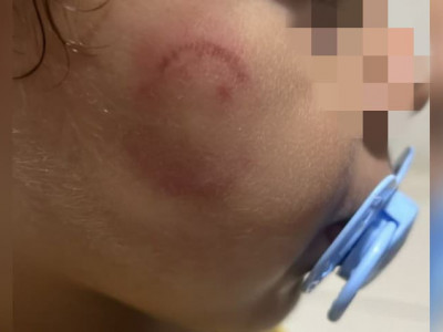 Avó denuncia agressões contra neto em escola infantil em Campo Grande Avó denuncia agressões contra neto em escola infantil em Campo Grande