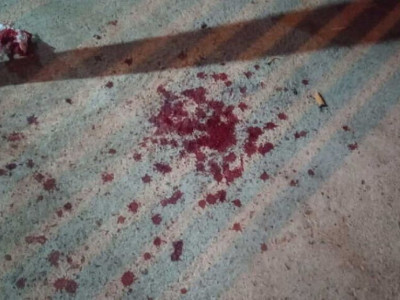 Mulher é esfaqueada pela cunhada durante briga familiar em Campo Grande Mulher é esfaqueada pela cunhada durante briga familiar em Campo Grande