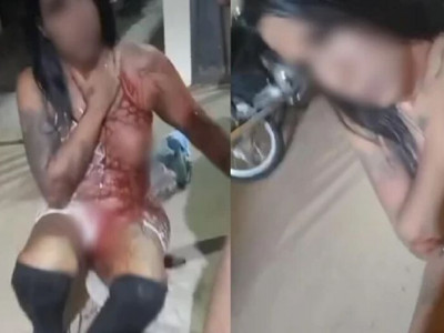 Travesti é esfaqueada no pescoço durante briga em avenida de Anastácio Travesti é esfaqueada no pescoço durante briga em avenida de Anastácio