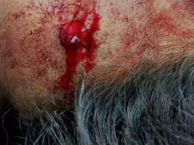 Mulher é baleada de raspão durante perseguição policial em Coxim Mulher é baleada de raspão durante perseguição policial em Coxim