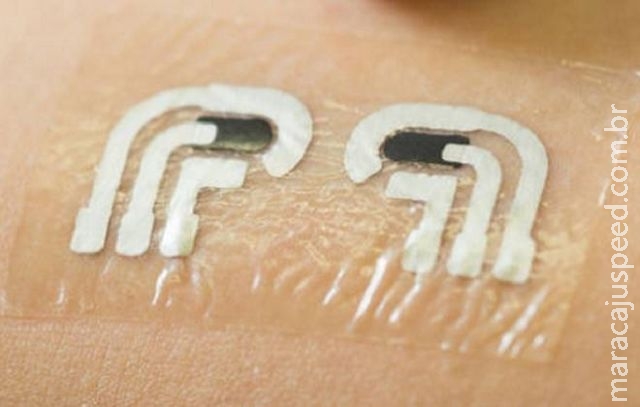 Tatuagem adesiva mede glicose no sangue Tatuagem adesiva mede glicose no sangue