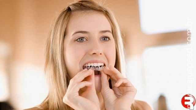 Anvisa proíbe venda de clareador dental sem prescrição