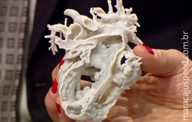Coração impresso em 3D salva vida de criança de 2 anos Coração impresso em 3D salva vida de criança de 2 anos