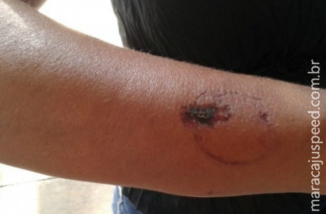 Assaltante leva tudo de loja e antes de sair morde todo o corpo da comerciante Assaltante leva tudo de loja e antes de sair morde todo o corpo da comerciante