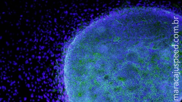 Cientistas descobrem maneira de controlar ritmo do coração em situações extremas Cientistas descobrem maneira de controlar ritmo do coração em situações extremas