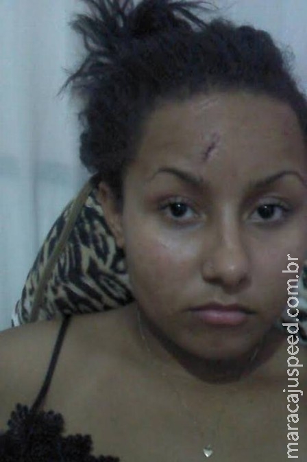 Jovem que tirou selfie após capotar lamenta vazamento de fotos e diz ter medo de sair na rua Jovem que tirou selfie após capotar lamenta vazamento de fotos e diz ter medo de sair na rua