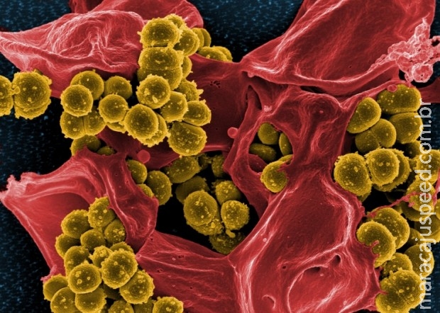 Antibiótico revolucionário impede que bactérias desenvolvam resistência Antibiótico revolucionário impede que bactérias desenvolvam resistência
