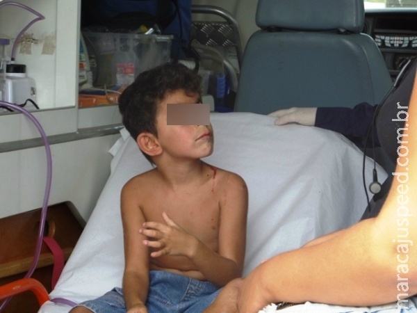 Menino de 06 anos cai de brinquedo e sofre traumatismo craniano Menino de 06 anos cai de brinquedo e sofre traumatismo craniano