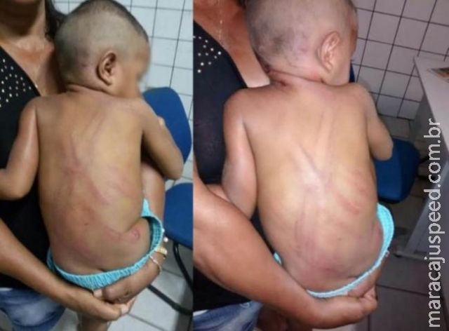 Criança de dois anos leva 50 chibatadas por defecar na cama e mãe pede soltura de suspeito Criança de dois anos leva 50 chibatadas por defecar na cama e mãe pede soltura de suspeito