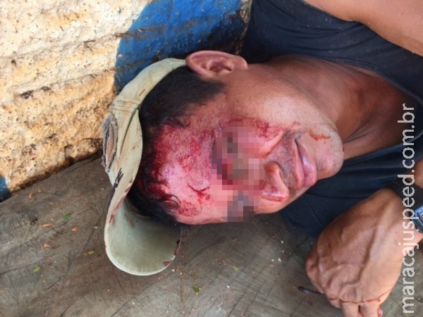 Amigos de “cachaça” brigam e um deles é ferido com bloco na cabeça Amigos de “cachaça” brigam e um deles é ferido com bloco na cabeça