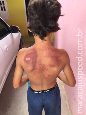 Padrasto é preso suspeito de agredir menino de 11 anos com sandália Padrasto é preso suspeito de agredir menino de 11 anos com sandália